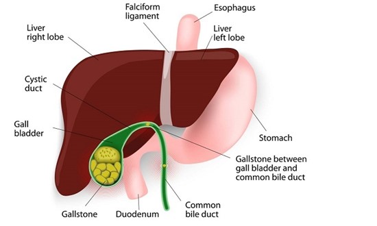 Gall Bladder Stone Symptoms, Causes and Treatment | No Side Effects ...
