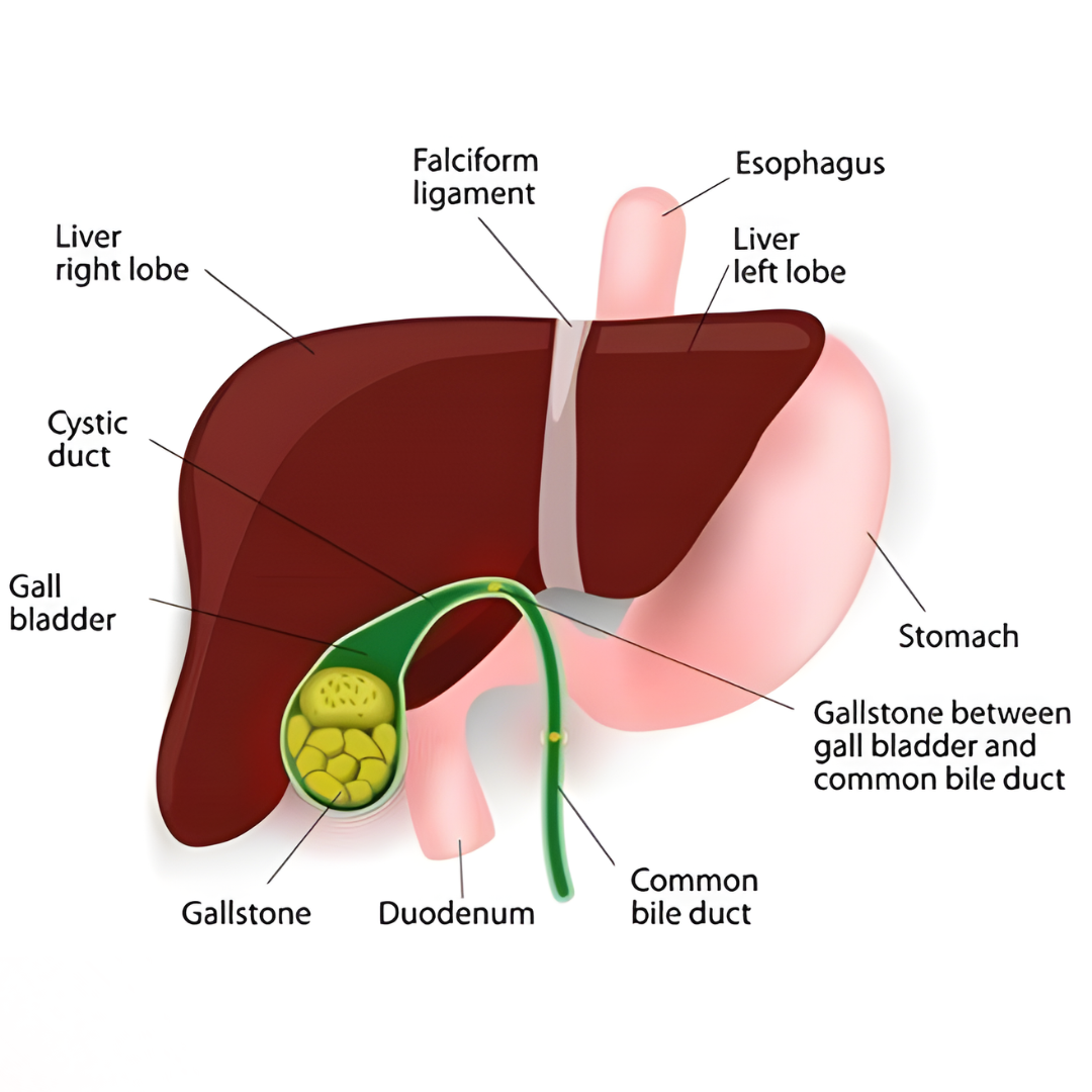 GALL BLADER  - Causes, Symptoms & Treatments with  Herbal |  Ayurvedic | Supplements