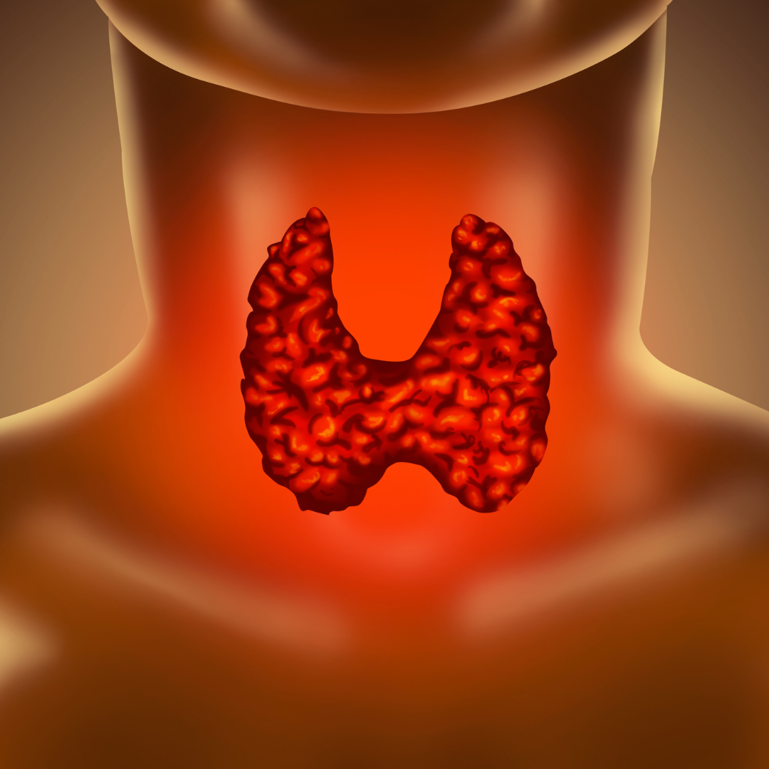 HYPOTHYROIDISM  - Causes, Symptoms & Treatments with  Herbal |  Ayurvedic | Supplements