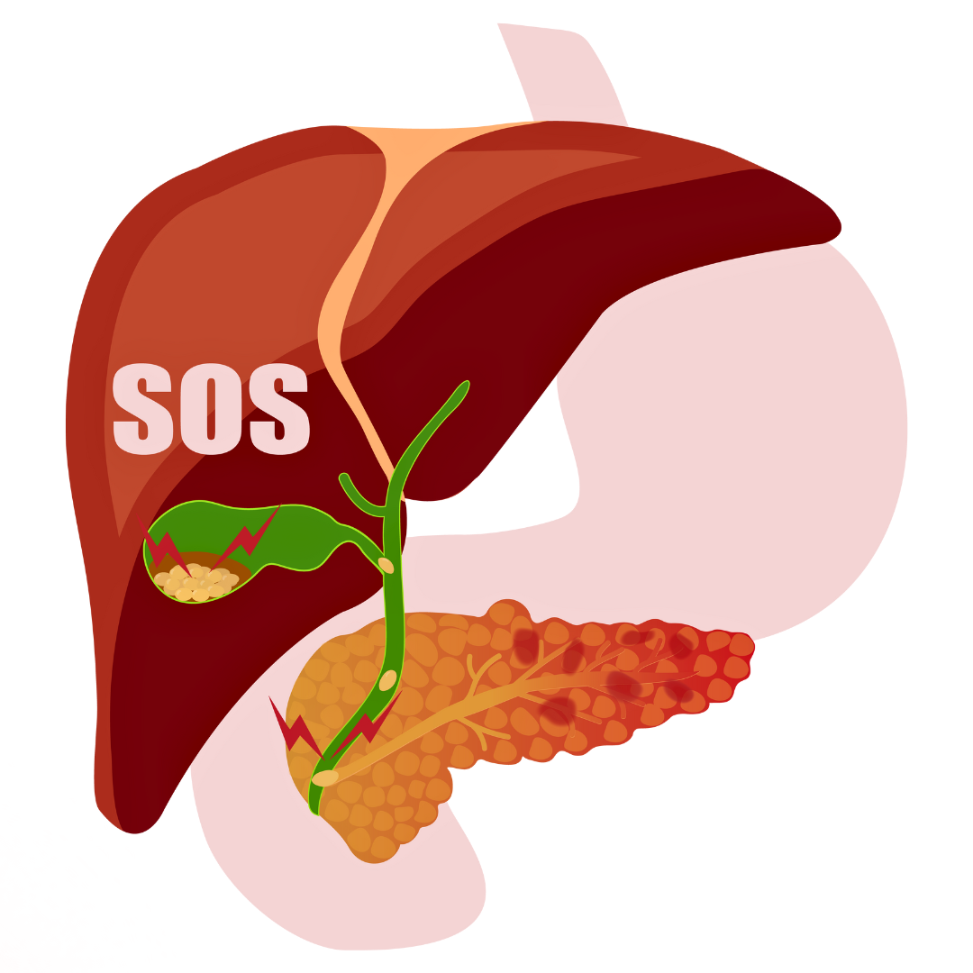 Liver Dsiorder herbal supplement