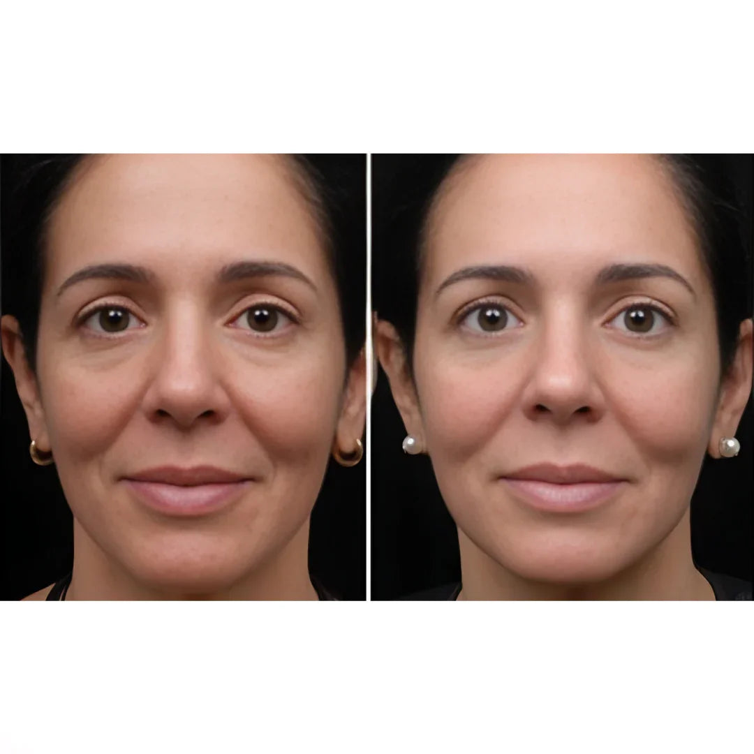 Antiaging & Vitalty -Causes, Symptoms & Treatments with  Herbal |  Ayurvedic | Supplements