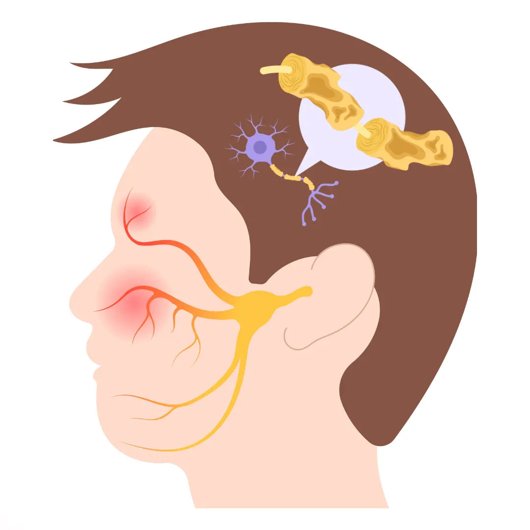 Multiple Sclerosis 