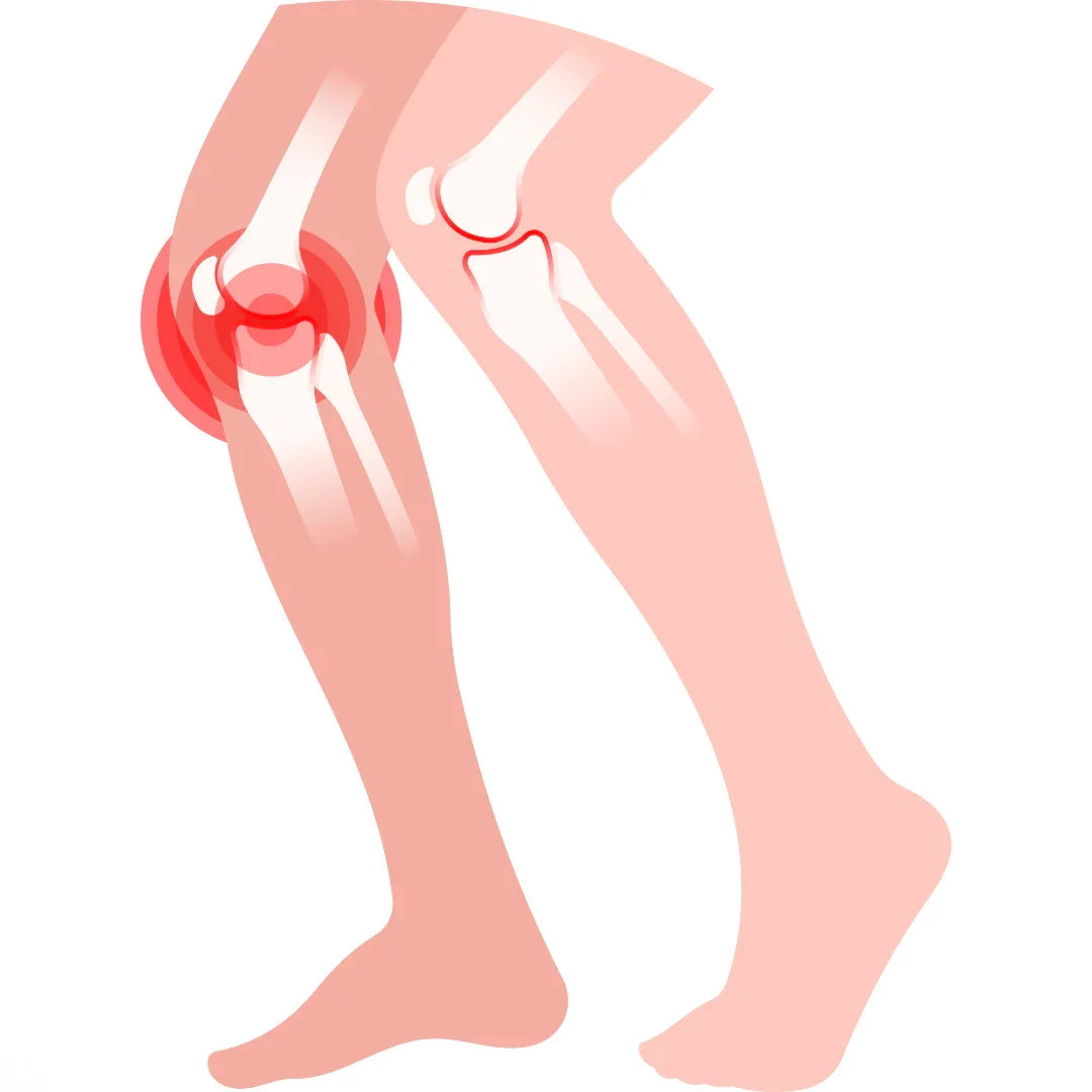 OSTEOARTHRITIS - Causes, Symptoms & Treatments with  Herbal |  Ayurvedic | Supplements