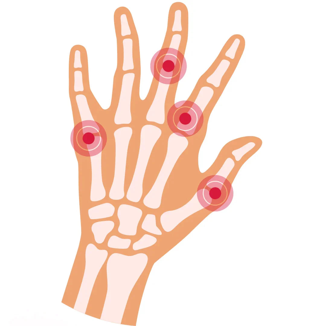 RHEUMATOID ARTHRITIS  - Causes, Symptoms & Treatments with  Herbal |  Ayurvedic | Supplements