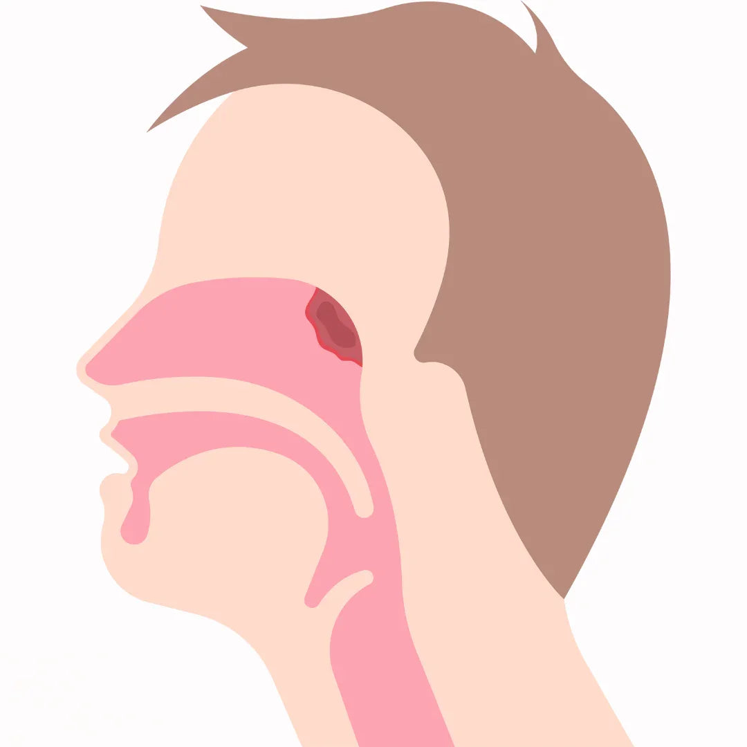 RESPIRATORY DISORDER  - Causes, Symptoms & Treatments with  Herbal |  Ayurvedic | Supplements